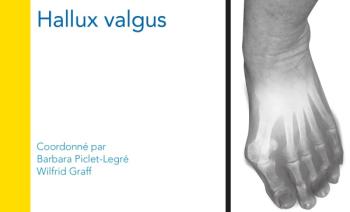 Livre chirurgie hallux valgus