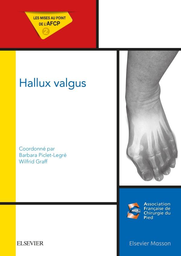 Livre chirurgie hallux valgus